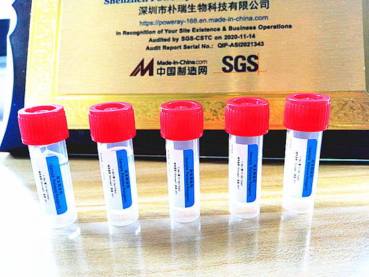 Covid-19 için SGS Onayı PCR Test Ev Kiti DNA ve RNA Ekstraksiyonu